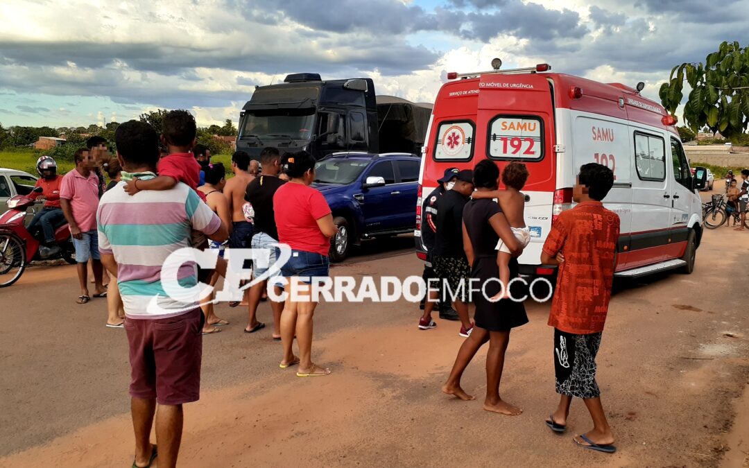 LEM: Criança tem pé amputado após ser atingida por caminhonete no bairro Santa Cruz III.